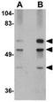 Polypeptide N-Acetylgalactosaminyltransferase 10 antibody, GTX17043, GeneTex, Western Blot image 