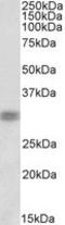Cone-Rod Homeobox antibody, TA320218, Origene, Western Blot image 