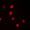 NOP2/Sun RNA Methyltransferase 6 antibody, orb341254, Biorbyt, Immunofluorescence image 