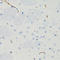 Galactose-1-Phosphate Uridylyltransferase antibody, LS-C334619, Lifespan Biosciences, Immunohistochemistry paraffin image 