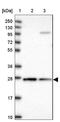 Cytochrome B5 Reductase 2 antibody, NBP1-85865, Novus Biologicals, Western Blot image 