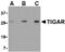 TP53 Induced Glycolysis Regulatory Phosphatase antibody, MBS150456, MyBioSource, Western Blot image 