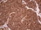Ret Proto-Oncogene antibody, LS-C790747, Lifespan Biosciences, Immunohistochemistry paraffin image 