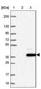 Coiled-Coil Domain Containing 190 antibody, NBP1-82674, Novus Biologicals, Western Blot image 
