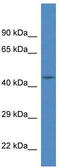 F-Box And Leucine Rich Repeat Protein 20 antibody, TA343034, Origene, Western Blot image 