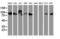 Dipeptidyl Peptidase 9 antibody, LS-C173749, Lifespan Biosciences, Western Blot image 