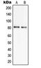 Solute Carrier Family 6 Member 17 antibody, GTX55991, GeneTex, Western Blot image 