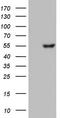 Glucosylceramidase Beta antibody, LS-C336840, Lifespan Biosciences, Western Blot image 
