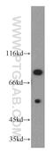 Cyclin T1 antibody, 20992-1-AP, Proteintech Group, Western Blot image 