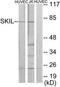 SKI Like Proto-Oncogene antibody, TA312882, Origene, Western Blot image 