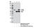 Succinate Dehydrogenase Complex Flavoprotein Subunit A antibody, 11998S, Cell Signaling Technology, Immunoprecipitation image 