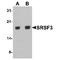 Serine And Arginine Rich Splicing Factor 3 antibody, TA349171, Origene, Western Blot image 