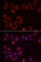 Pyridoxal kinase antibody, STJ28770, St John