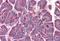 Platelet Activating Factor Acetylhydrolase 1b Regulatory Subunit 1 antibody, GTX89916, GeneTex, Immunohistochemistry paraffin image 