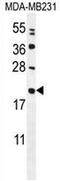 Coiled-Coil-Helix-Coiled-Coil-Helix Domain Containing 4 antibody, AP52691PU-N, Origene, Western Blot image 
