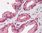 Pentraxin 3 antibody, ARP56498_P050, Aviva Systems Biology, Immunohistochemistry paraffin image 