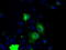 Serine/threonine-protein kinase PRKY antibody, LS-C784368, Lifespan Biosciences, Immunofluorescence image 