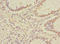 Ubiquitin-associated protein 1 antibody, A67530-100, Epigentek, Immunohistochemistry paraffin image 