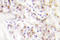 Kinesin Family Member 20A antibody, LS-C177332, Lifespan Biosciences, Immunohistochemistry paraffin image 