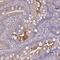CD121a antibody, HPA029560, Atlas Antibodies, Immunohistochemistry frozen image 