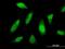 PTTG1 Interacting Protein antibody, H00000754-M04, Novus Biologicals, Immunofluorescence image 
