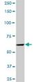 Pre-MRNA Processing Factor 4 antibody, H00009128-B01P, Novus Biologicals, Western Blot image 