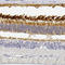 PDE6B antibody, HPA059929, Atlas Antibodies, Immunohistochemistry paraffin image 