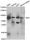 Bruton Tyrosine Kinase antibody, abx001327, Abbexa, Western Blot image 
