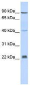 Insulin Induced Gene 2 antibody, TA345661, Origene, Western Blot image 