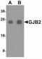 Gap Junction Protein Beta 2 antibody, NBP2-41304, Novus Biologicals, Western Blot image 