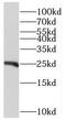 Regulatory Factor X Associated Protein antibody, FNab07260, FineTest, Western Blot image 