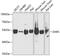 Aspartyl-TRNA Synthetase antibody, 22-323, ProSci, Western Blot image 
