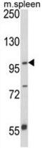 Anoctamin-5 antibody, GTX81161, GeneTex, Western Blot image 