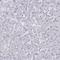 Oligodendrocyte Myelin Glycoprotein antibody, NBP1-82483, Novus Biologicals, Immunohistochemistry paraffin image 