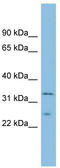 Methionine Sulfoxide Reductase A antibody, TA345122, Origene, Western Blot image 