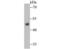 Ectonucleoside Triphosphate Diphosphohydrolase 5 (Inactive) antibody, NBP2-80455, Novus Biologicals, Western Blot image 