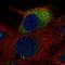 Beta-sarcoglycan antibody, HPA058656, Atlas Antibodies, Immunocytochemistry image 