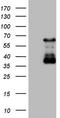 Calcium/Calmodulin Dependent Protein Kinase II Beta antibody, CF808346, Origene, Western Blot image 