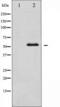 Checkpoint Kinase 1 antibody, TA325361, Origene, Western Blot image 