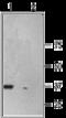 P2X purinoceptor 6 antibody, GTX16843, GeneTex, Western Blot image 