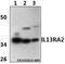 Interleukin 13 Receptor Subunit Alpha 2 antibody, LS-C412191, Lifespan Biosciences, Western Blot image 