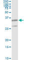Proteasome Subunit Beta 8 antibody, LS-C133416, Lifespan Biosciences, Immunoprecipitation image 