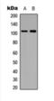 Histone Deacetylase 7 antibody, orb393312, Biorbyt, Western Blot image 