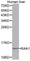 Serum Amyloid A1 antibody, abx001392, Abbexa, Western Blot image 