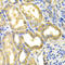 Dihydropyrimidine Dehydrogenase antibody, STJ23425, St John
