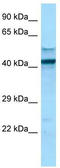 High affinity immunoglobulin gamma Fc receptor I antibody, TA343349, Origene, Western Blot image 