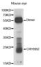 Crystallin Beta B2 antibody, abx000083, Abbexa, Western Blot image 