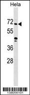 Zinc Finger Protein 280B antibody, 59-483, ProSci, Western Blot image 