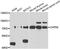 Calpain-5 antibody, A7428, ABclonal Technology, Western Blot image 