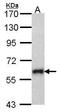 Suppressor of cytokine signaling 5 antibody, GTX104722, GeneTex, Western Blot image 